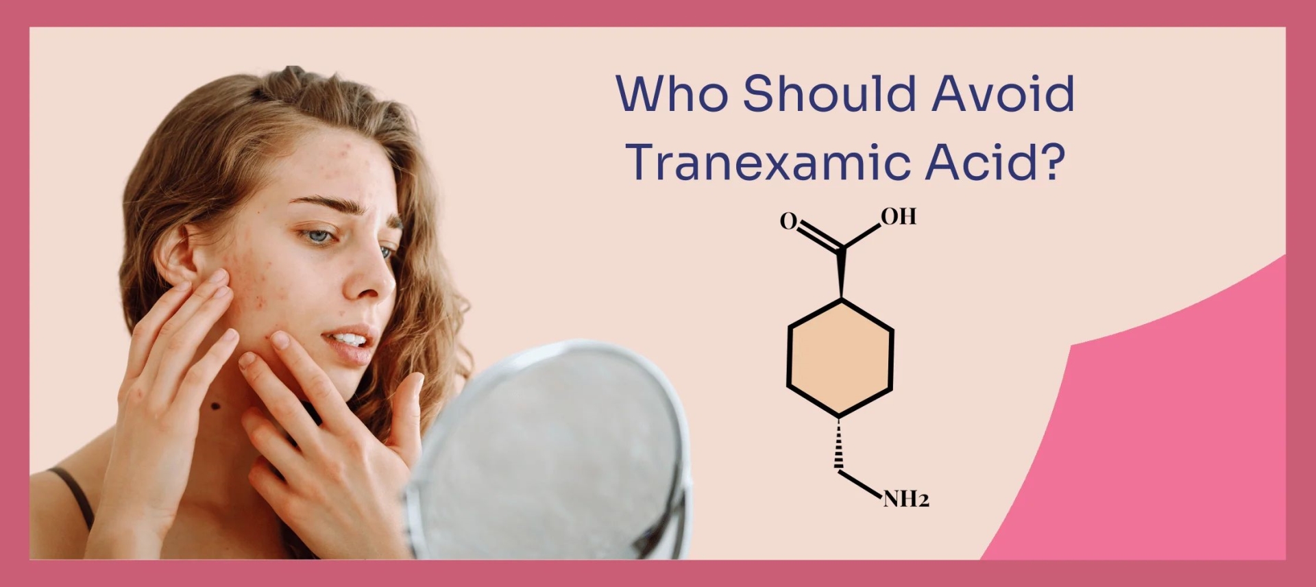 网红“氨甲环酸”被批准用于色斑治疗了吗？